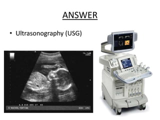 ANSWER
• Ultrasonography (USG)
 
