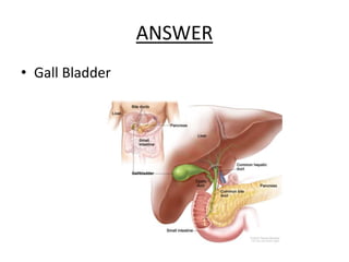 ANSWER
• Gall Bladder
 