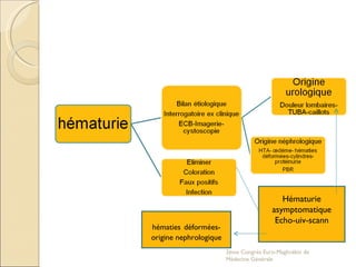 Hématurie asymptomatique Echo-uiv-scann hématies   déformées-origine nephrologique 2eme Congrés Euro-Maghrébin de Médecine Générale 