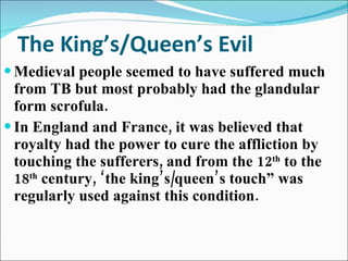 The King’s/Queen’s Evil Medieval people seemed to have suffered much from TB but most probably had the glandular form scrofula. In England and France, it was believed that royalty had the power to cure the affliction by touching the sufferers, and from the 12 th  to the 18 th  century, ‘the king’s/queen’s touch” was regularly used against this condition. 