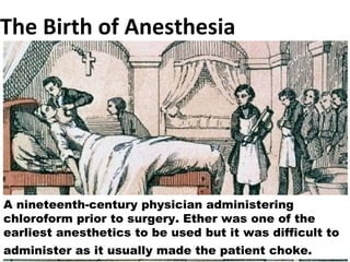 The Birth of Anesthesia A nineteenth-century physician administering chloroform prior to surgery. Ether was one of the earliest anesthetics to be used but it was difficult to administer as it usually made the patient choke.   