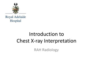 Introduction to
Chest X-ray Interpretation
RAH Radiology
 