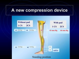 A new compression device 1 CS  2CS Without pad ankle With pad   1 CS  2CS 23 42 12 22 43 mm Hg  66 mm Hg   Standing position   