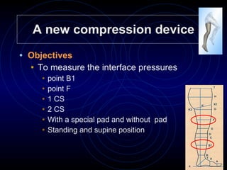 A new compression device Objectives  To measure the interface pressures point B1 point F 1 CS  2 CS With a special pad and without  pad Standing and supine position 