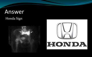 Answer
Honda Sign
 