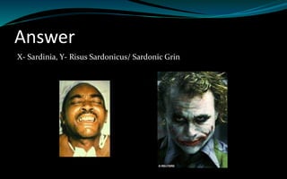 Answer
X- Sardinia, Y- Risus Sardonicus/ Sardonic Grin
 
