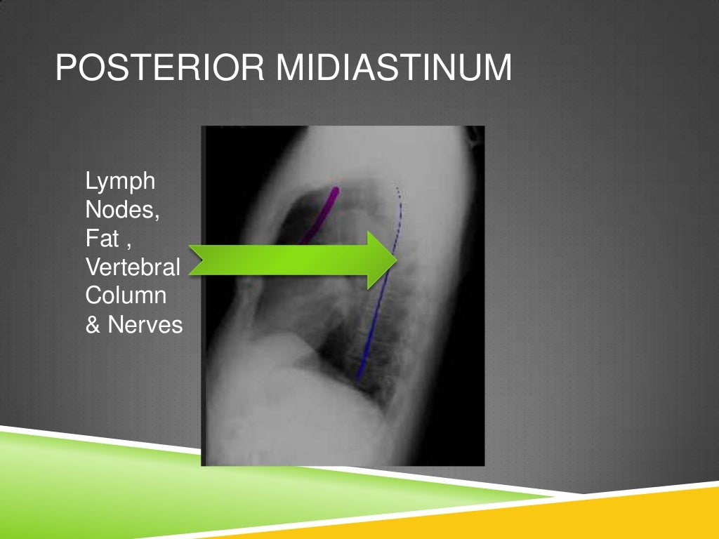 CT ANATOMY OF NORMAL MEDIASTINUM MADE EASY