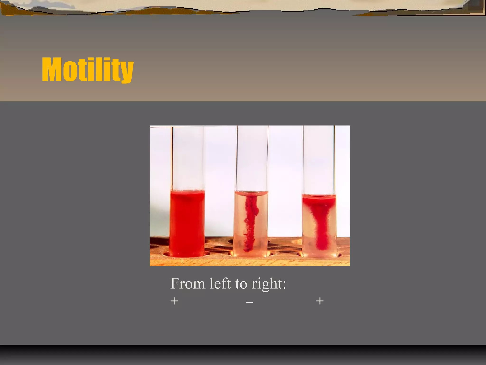 Motility
From left to right:
+ – +
 