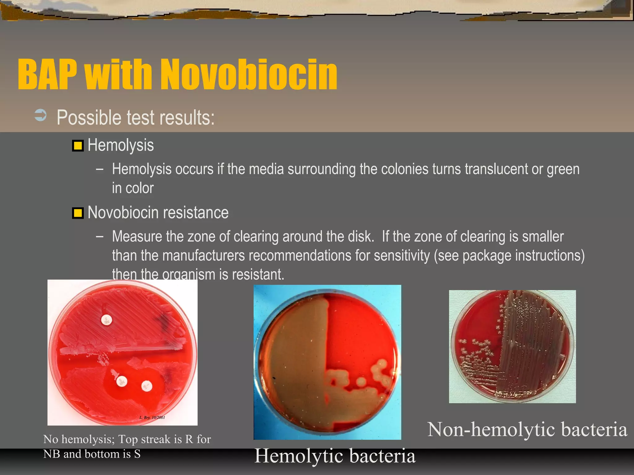 BAP with Novobiocin
 Possible test results:
Hemolysis
– Hemolysis occurs if the media surrounding the colonies turns translucent or green
in color
Novobiocin resistance
– Measure the zone of clearing around the disk. If the zone of clearing is smaller
than the manufacturers recommendations for sensitivity (see package instructions)
then the organism is resistant.
No hemolysis; Top streak is R for
NB and bottom is S Hemolytic bacteria
Non-hemolytic bacteria
 