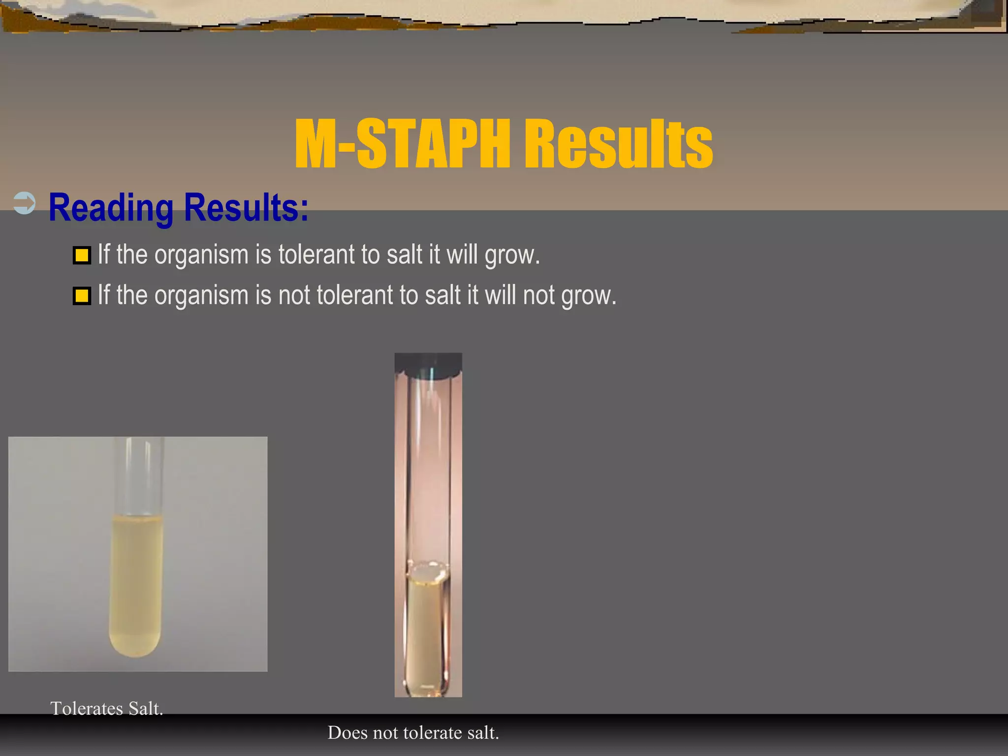 M-STAPH Results
 Reading Results:
If the organism is tolerant to salt it will grow.
If the organism is not tolerant to salt it will not grow.
Tolerates Salt.
Does not tolerate salt.
 