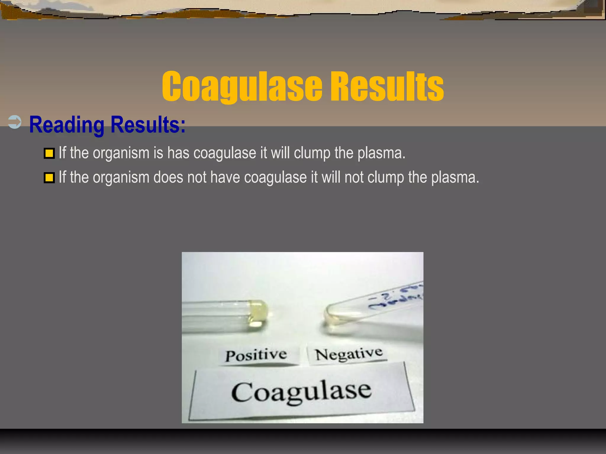 Coagulase Results
 Reading Results:
If the organism is has coagulase it will clump the plasma.
If the organism does not have coagulase it will not clump the plasma.
 