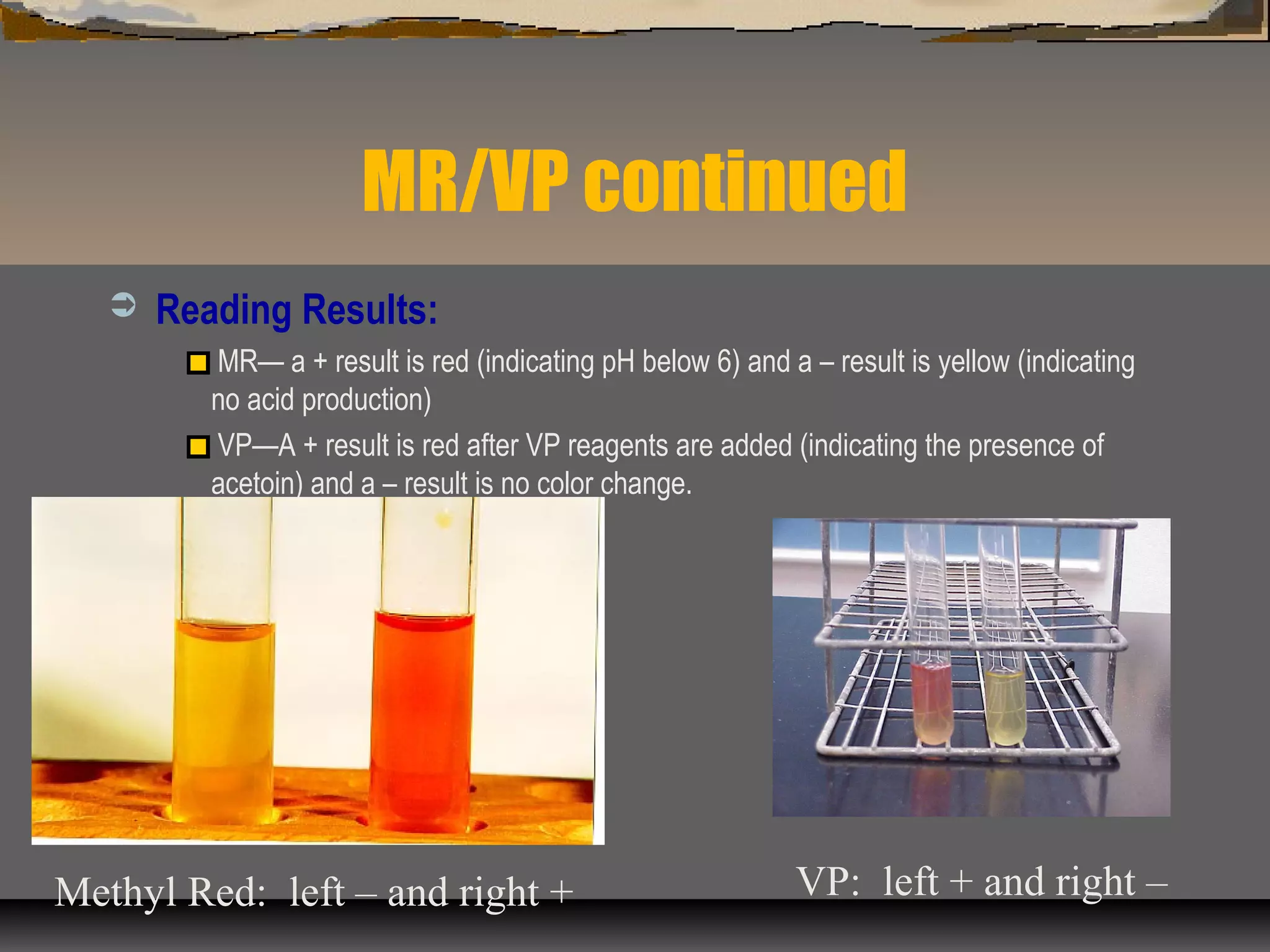 MR/VP continued
 Reading Results:
MR— a + result is red (indicating pH below 6) and a – result is yellow (indicating
no acid production)
VP—A + result is red after VP reagents are added (indicating the presence of
acetoin) and a – result is no color change.
Methyl Red: left – and right + VP: left + and right –
 