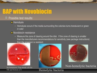 Media biochemical tests | PPT