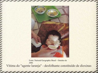 Vítima do &quot;agente laranja&quot; - desfolhante constituído de dioxinas Fonte: National Geographic Brasil – Outubro de 2006 