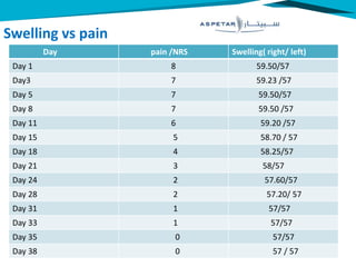 Swelling vs pain
Day pain /NRS Swelling( right/ left)
Day 1 8 59.50/57
Day3 7 59.23 /57
Day 5 7 59.50/57
Day 8 7 59.50 /57
Day 11 6 59.20 /57
Day 15 5 58.70 / 57
Day 18 4 58.25/57
Day 21 3 58/57
Day 24 2 57.60/57
Day 28 2 57.20/ 57
Day 31 1 57/57
Day 33 1 57/57
Day 35 0 57/57
Day 38 0 57 / 57
 
