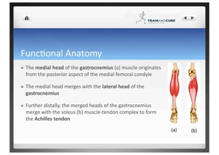 Medial calf muscle rupture | PDF