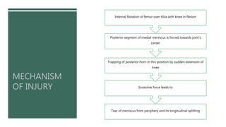 Medial meniscus injury and physiotherapy treatment @Dr.Muskan Rastogi ...