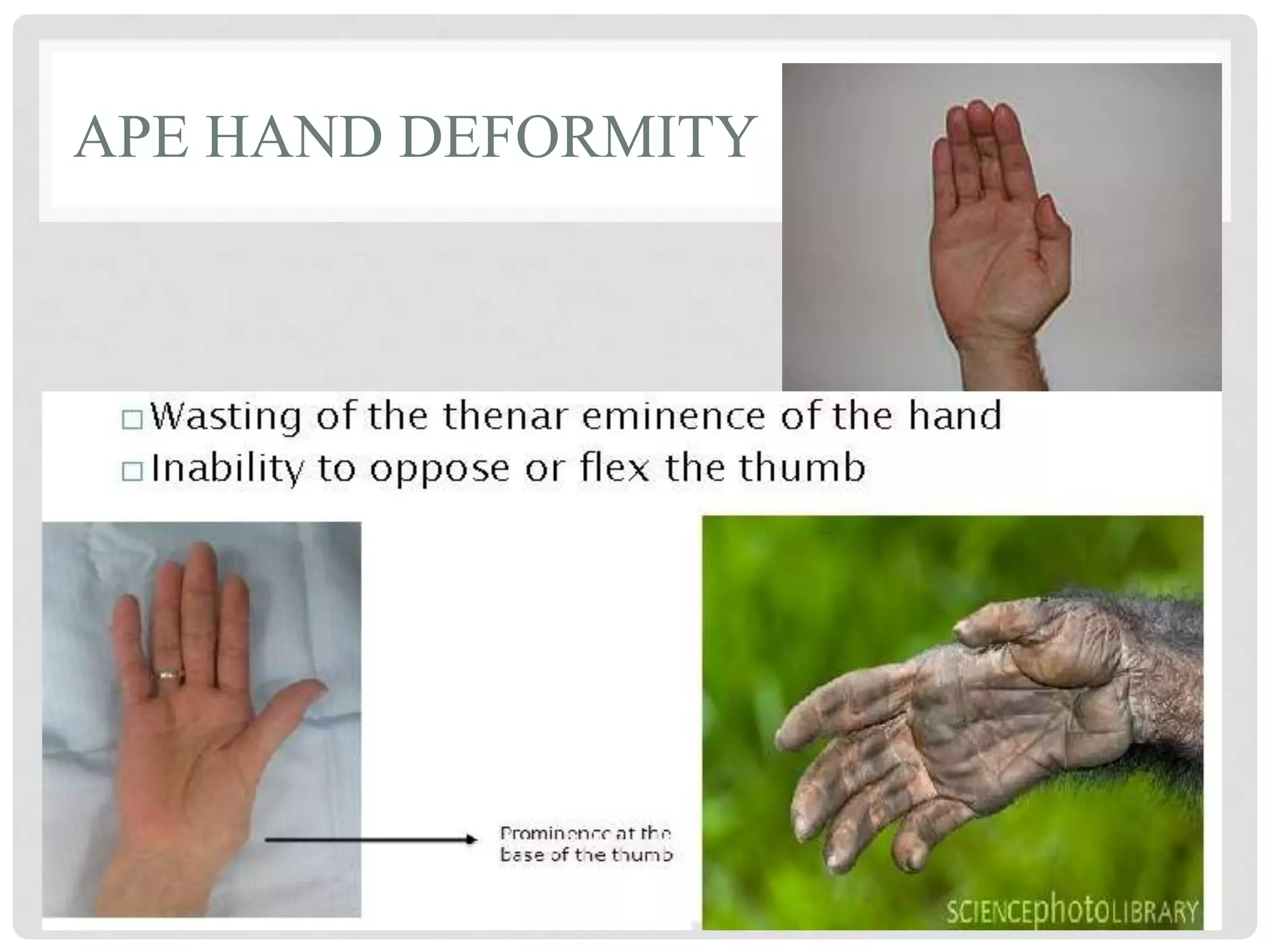 Median nerve.pptx