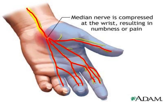 where can i get a emg nurve pain test in tiffin where can i get a emg nurve pain test in tiffin