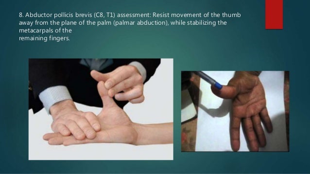 Median nerve injuries