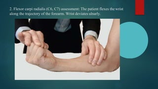 2. Flexor carpi radialis (C6, C7) assessment: The patient flexes the wrist
along the trajectory of the forearm. Wrist deviates ulnarly.
 
