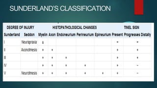 SUNDERLAND’S CLASSIFICATION
 