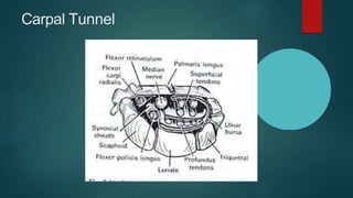 Carpal Tunnel
 