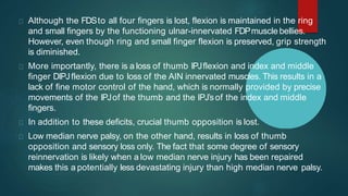 Although the FDSto all four fingers is lost, flexion is maintained in the ring
and small fingers by the functioning ulnar-innervated FDPmuscle bellies.
However, even though ring and small finger flexion is preserved, grip strength
is diminished.
More importantly, there is a loss of thumb IPJflexion and index and middle
finger DIPJflexion due to loss of the AIN innervated muscles. This results in a
lack of fine motor control of the hand, which is normally provided by precise
movements of the IPJof the thumb and the IPJ’sof the index and middle
fingers.
In addition to these deficits, crucial thumb opposition is lost.
Low median nerve palsy, on the other hand, results in loss of thumb
opposition and sensory loss only. The fact that some degree of sensory
reinnervation is likely when a low median nerve injury has been repaired
makes this a potentially less devastating injury than high median nerve palsy.
 