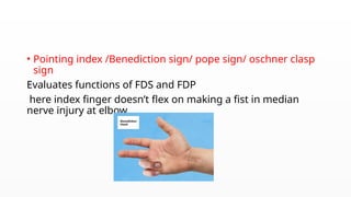 Fds Injuries MEDIAN NERVE INJURIES ortho presentation 2.pptx