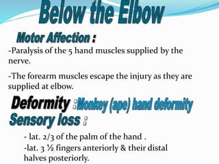 - lat. 2/3 of the palm of the hand .
-lat. 3 ½ fingers anteriorly & their distal
halves posteriorly.
-Paralysis of the 5 hand muscles supplied by the
nerve.
-The forearm muscles escape the injury as they are
supplied at elbow.
 