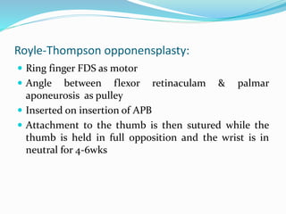 Royle-Thompson opponensplasty:
 Ring finger FDS as motor
 Angle between flexor retinaculam & palmar
aponeurosis as pulley
 Inserted on insertion of APB
 Attachment to the thumb is then sutured while the
thumb is held in full opposition and the wrist is in
neutral for 4-6wks
 