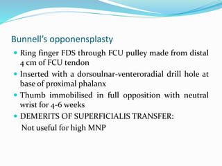 Bunnell’s opponensplasty
 Ring finger FDS through FCU pulley made from distal
4 cm of FCU tendon
 Inserted with a dorsoulnar-venteroradial drill hole at
base of proximal phalanx
 Thumb immobilised in full opposition with neutral
wrist for 4-6 weeks
 DEMERITS OF SUPERFICIALIS TRANSFER:
Not useful for high MNP
 