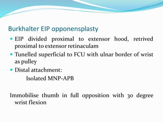 Burkhalter EIP opponensplasty
 EIP divided proximal to extensor hood, retrived
proximal to extensor retinaculam
 Tunelled superficial to FCU with ulnar border of wrist
as pulley
 Distal attachment:
Isolated MNP-APB
Immobilise thumb in full opposition with 30 degree
wrist flexion
 