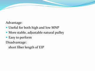 Advantage:
 Useful for both high and low MNP
 More stable, adjustable natural pulley
 Easy to perform
Disadvantage:
short fiber length of EIP
 