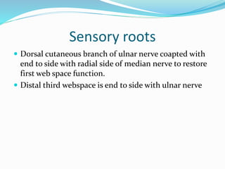 Sensory roots
 Dorsal cutaneous branch of ulnar nerve coapted with
end to side with radial side of median nerve to restore
first web space function.
 Distal third webspace is end to side with ulnar nerve
 