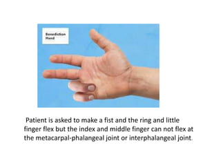 Patient is asked to make a fist and the ring and little
finger flex but the index and middle finger can not flex at
the metacarpal-phalangeal joint or interphalangeal joint.
 