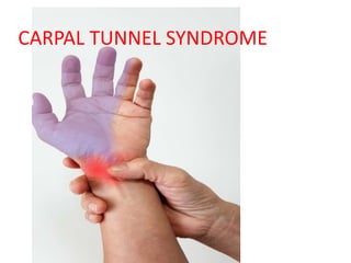 CARPAL TUNNEL SYNDROME
 