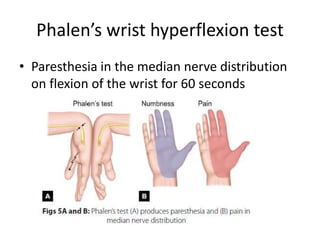 Phalen’s wrist hyperflexion test
• Paresthesia in the median nerve distribution
on flexion of the wrist for 60 seconds
 