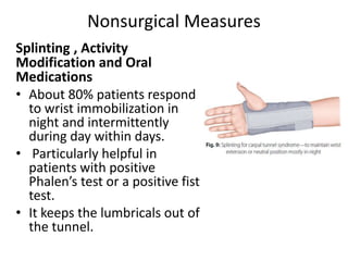 Nonsurgical Measures
Splinting , Activity
Modification and Oral
Medications
• About 80% patients respond
to wrist immobilization in
night and intermittently
during day within days.
• Particularly helpful in
patients with positive
Phalen’s test or a positive fist
test.
• It keeps the lumbricals out of
the tunnel.
 