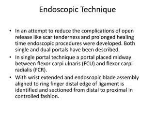 Endoscopic Technique
• In an attempt to reduce the complications of open
release like scar tenderness and prolonged healing
time endoscopic procedures were developed. Both
single and dual portals have been described.
• In single portal technique a portal placed midway
between flexor carpi ulnaris (FCU) and flexor carpi
radialis (FCR).
• With wrist extended and endoscopic blade assembly
aligned to ring finger distal edge of ligament is
identified and sectioned from distal to proximal in
controlled fashion.
 