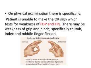 • On physical examination there is specifically:
Patient is unable to make the OK sign which
tests for weakness of FDP and FPL. There may be
weakness of grip and pinch, specifically thumb,
index and middle finger flexion.
 