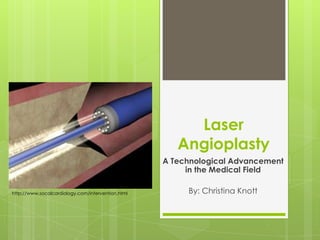 Laser
                                                      Angioplasty
                                                   A Technological Advancement
                                                        in the Medical Field

http://www.socalcardiology.com/intervention.html        By: Christina Knott
 