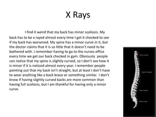 X Rays
           I find it weird that my back has minor scoliosis. My
back has to be x rayed almost every time I get it checked to see
if my back has worsened. My spine has a minor curve in it, but
the doctor claims that it is so little that it doesn’t need to be
bothered with. I remember having to go to the nurses office
every time we get our back checked in gym. Obviously people
can notice that my spine is slightly curved, so I don’t see how it
is minor if it is noticed almost every year. I remember people
pointing out that my back isn’t straight, but at least I don’t have
to wear anything like a back brace or something similar. I don’t
know if having slightly curved backs are more common than
having full scoliosis, but I am thankful for having only a minor
curve.
 