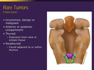 Mediastinal  Pathology  Compartmental  Approach