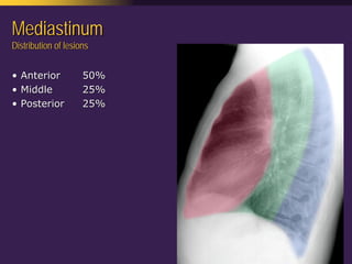 Mediastinal  Pathology  Compartmental  Approach