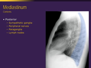 Mediastinal  Pathology  Compartmental  Approach
