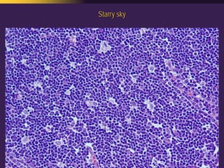 Mediastinal  Pathology  Compartmental  Approach