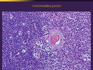 Mediastinal  Pathology  Compartmental  Approach