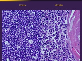Mediastinal  Pathology  Compartmental  Approach