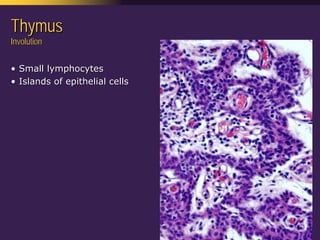 Mediastinal  Pathology  Compartmental  Approach